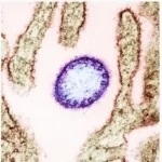 Apa itu virus Nipah, ini fakta penyebarannya