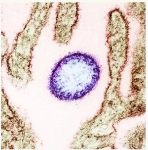Apa itu virus Nipah, ini fakta penyebarannya