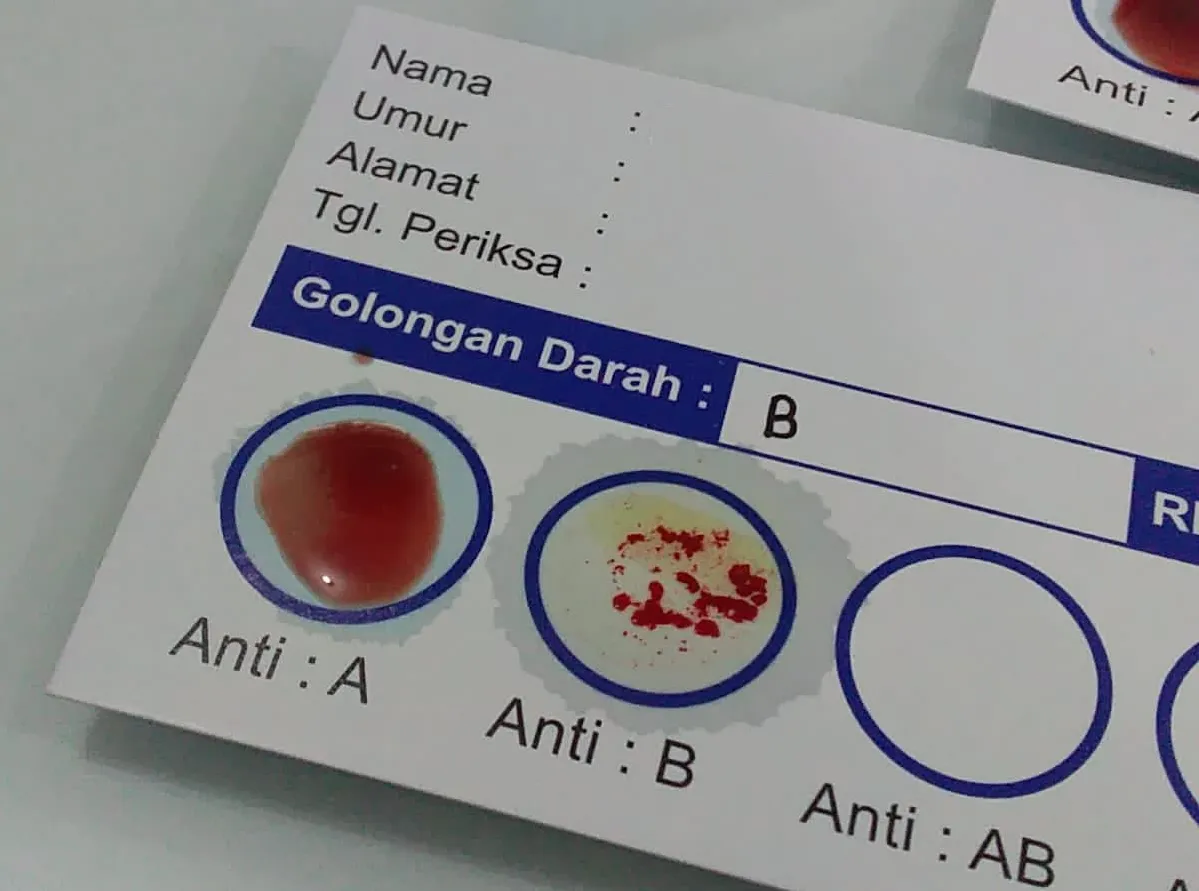 golongan darah B awet muda